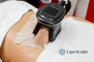Cryolipolysis Helping You Getting that Perfect Summer Body 3 Cryolipolysis Warwickshire can give you the best summer body - contact us today!